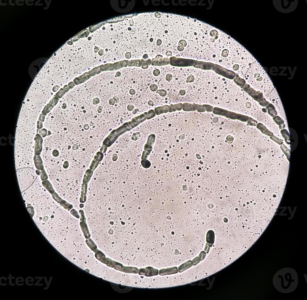 Microscopic image showing Hyphae of dermatophytes,, skin scraping for fungus test photo