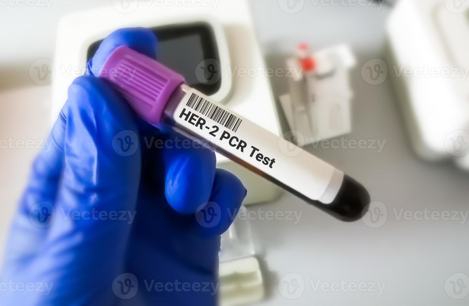 Blood sample for Her-2 or human epidermal growth factor receptor 2 PCR testing for breast cancer diagnosis. photo