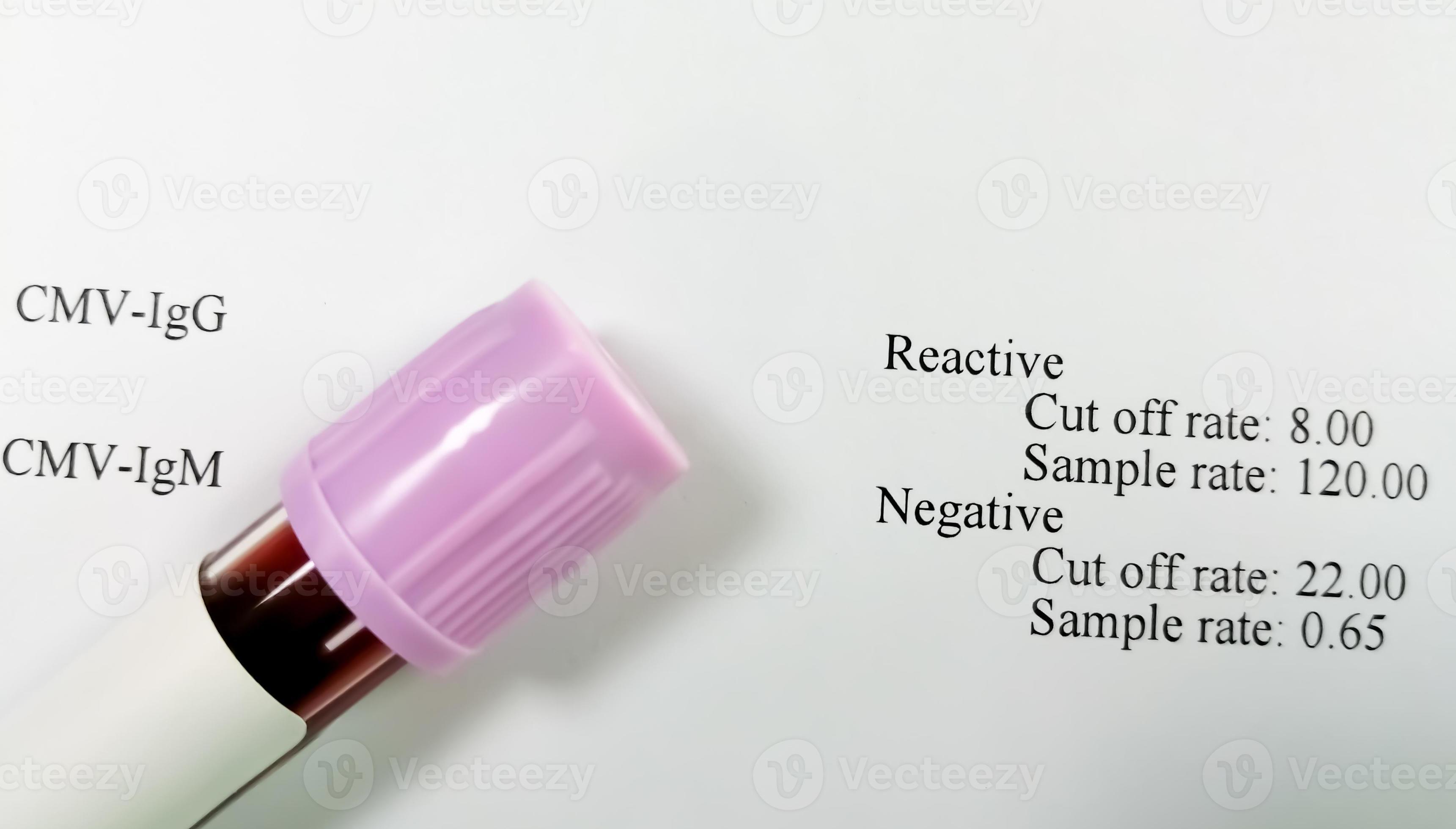 tubo de muestra de sangre para pruebas de anticuerpos de