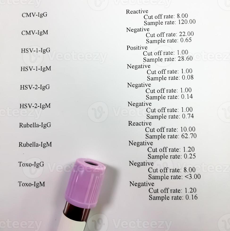 Blood sample isolated on patient report, TORCH panel testing. photo