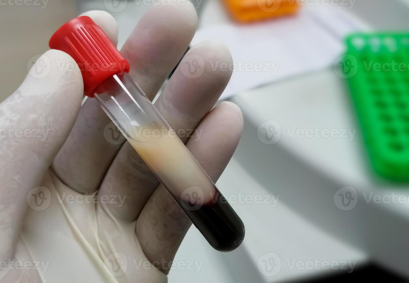 Scientist or Biochemist hold test tube with Lipemic blood sample. High