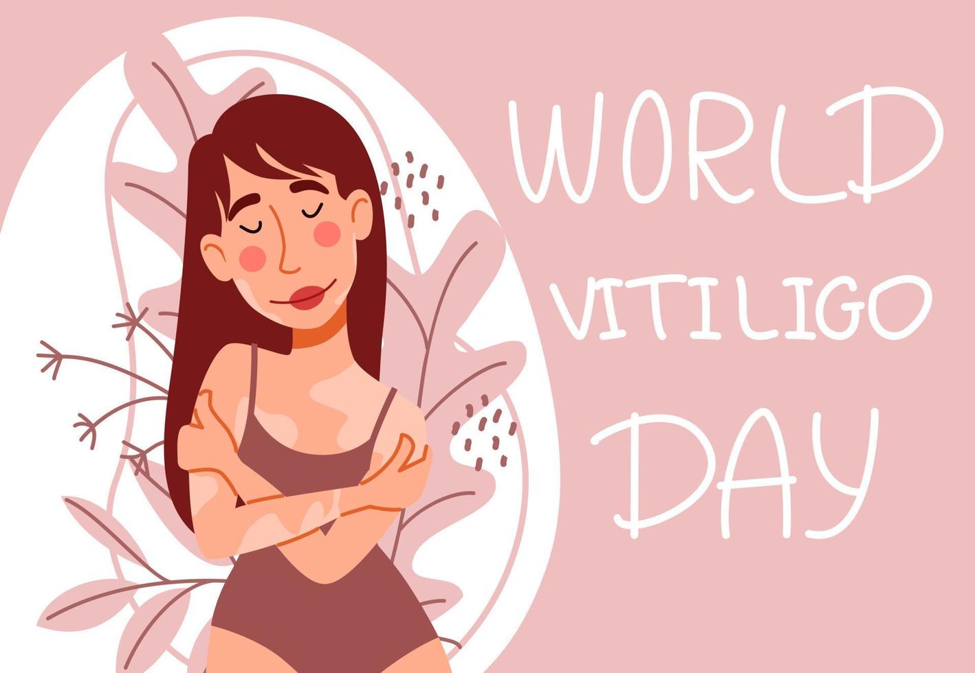 Beautiful girl with long hair in a swimsuit and with vitiligo. Postcard for World Vitiligo Day. vector