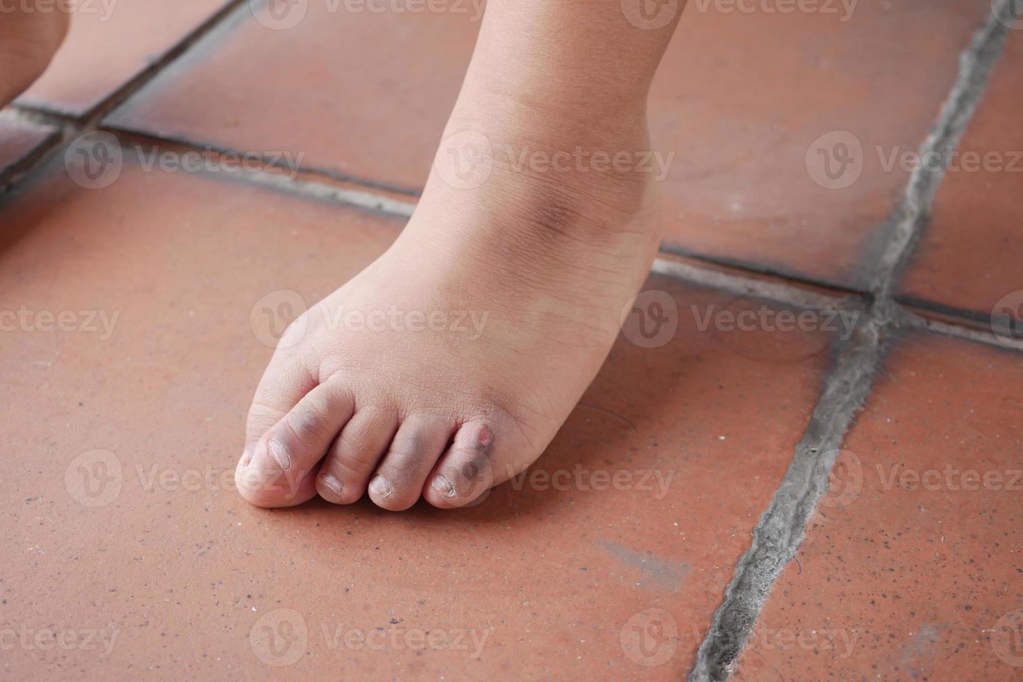 close up of 5 years old child dry feet on floor photo