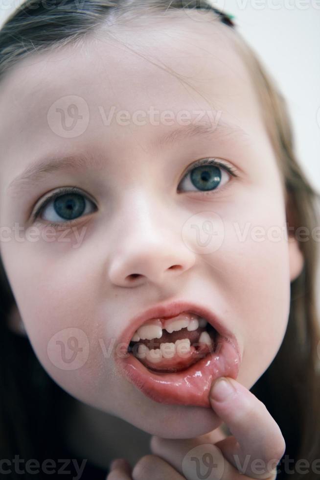 little girl without tooth smiling photo