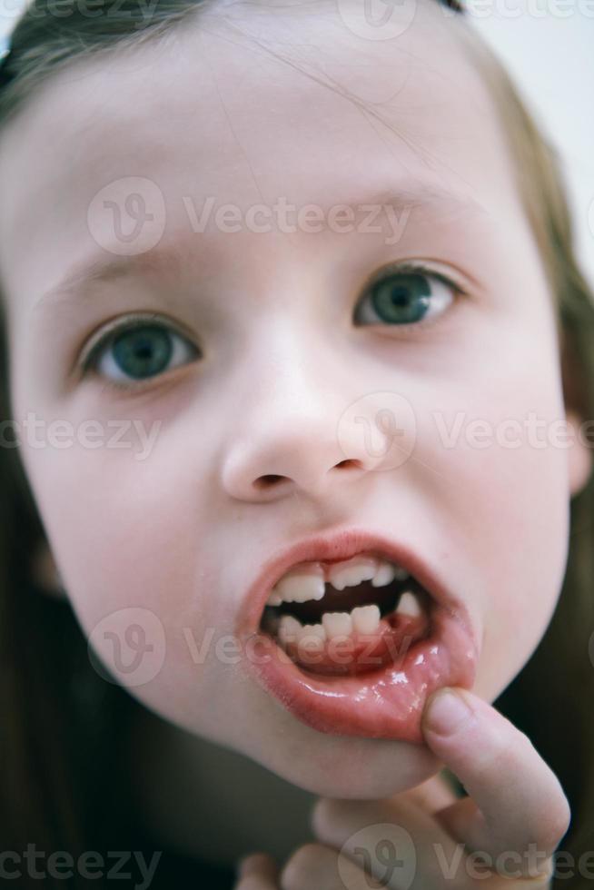 little girl without tooth smiling photo