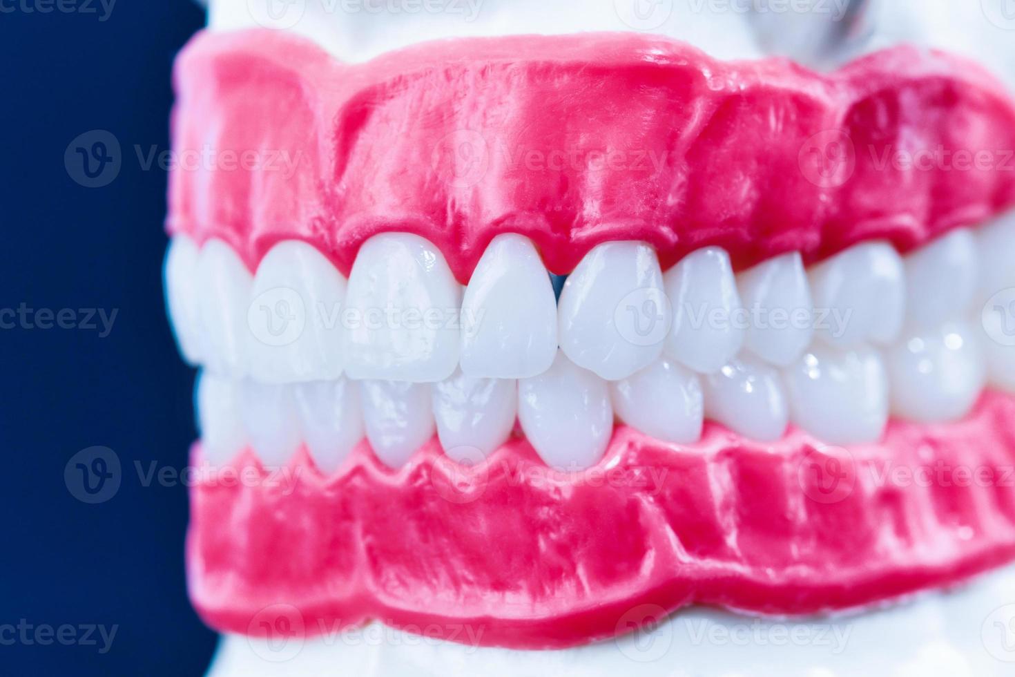 modelo de anatomía de mandíbula humana con dientes y encías foto