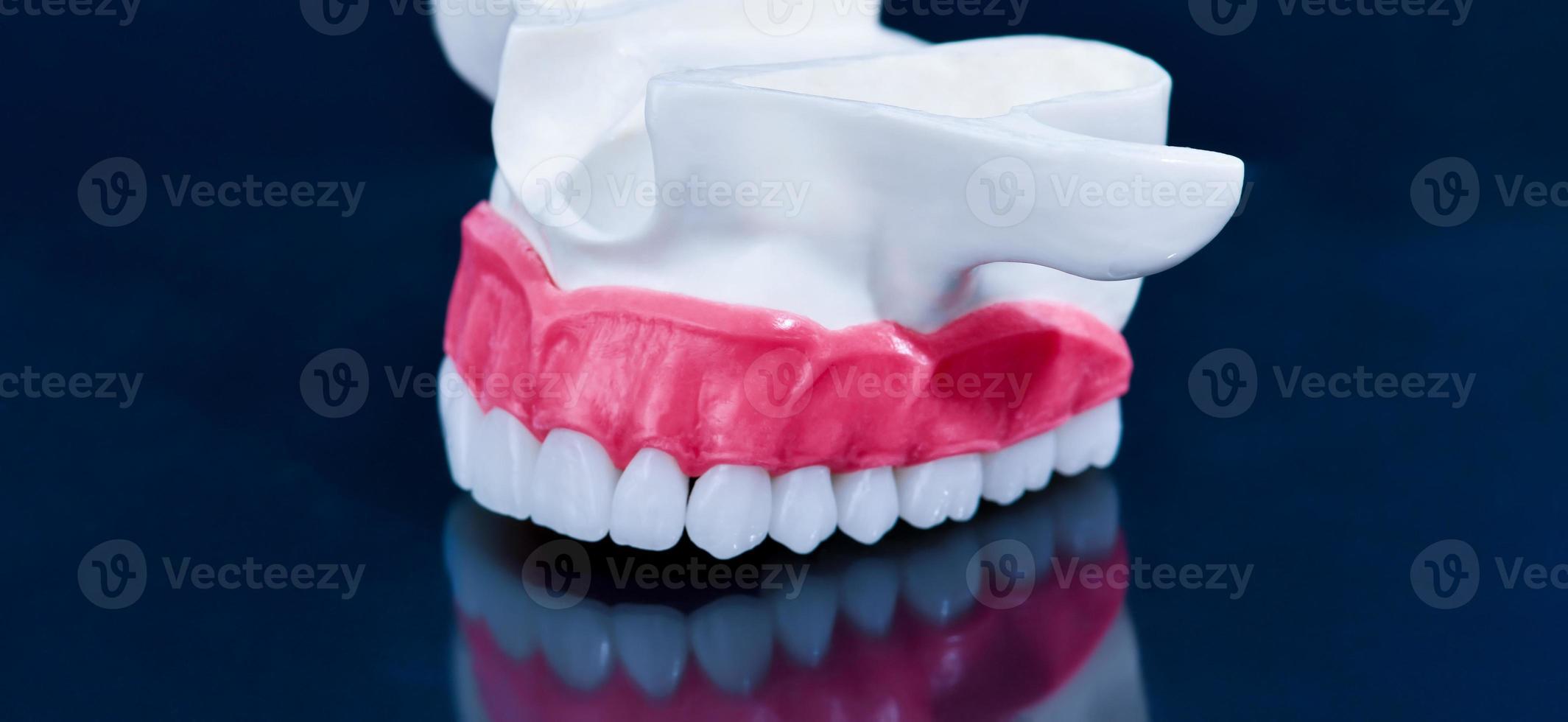 Upper human jaw model with a reflection on the glass photo