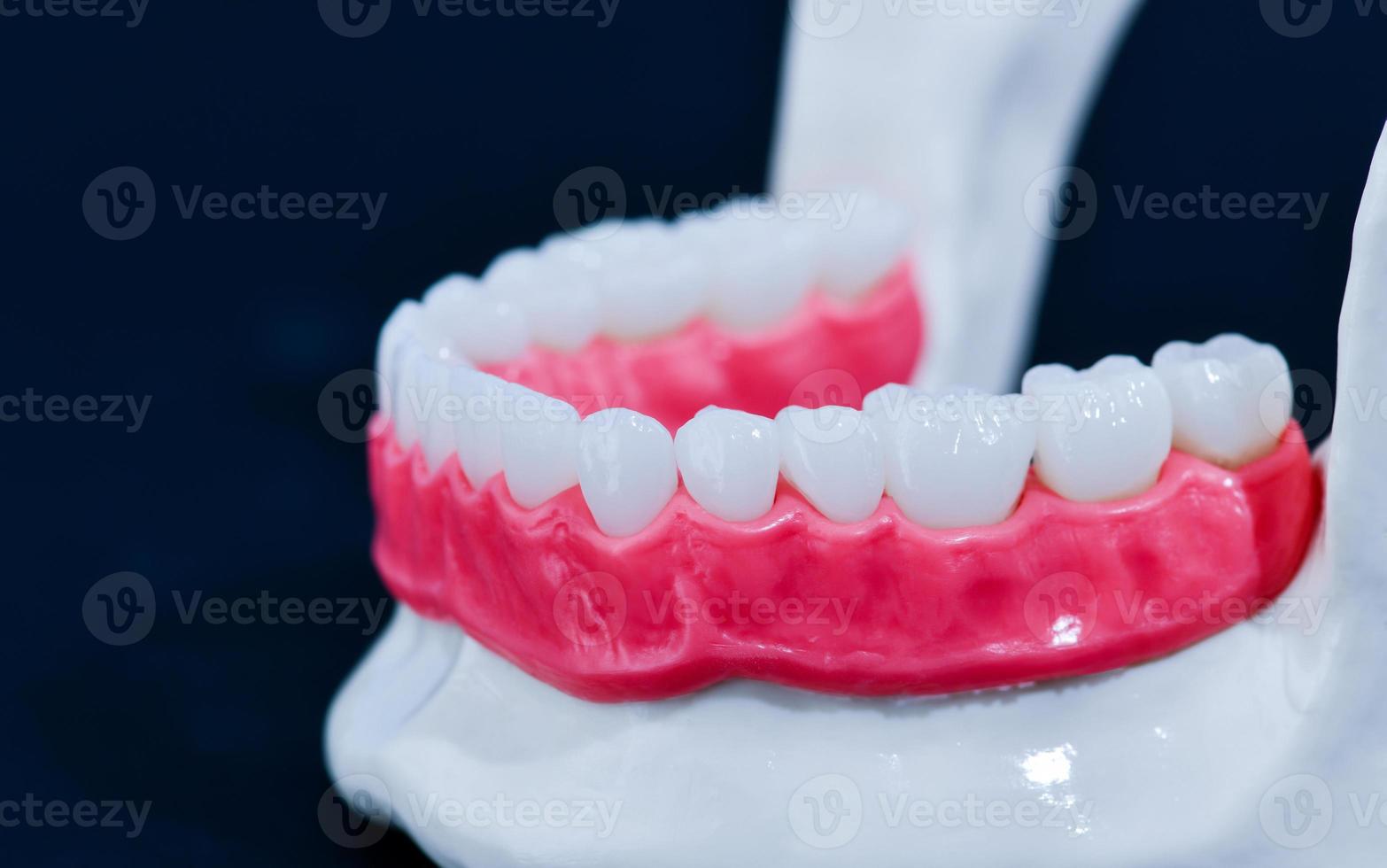 Lower human jaw with teeth and gums anatomy model photo