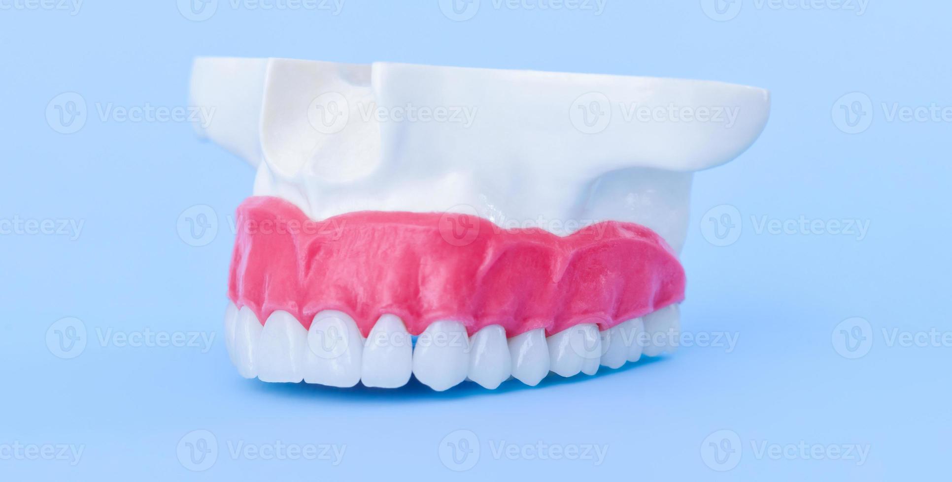 Upper human jaw with teeth and gums anatomy model photo