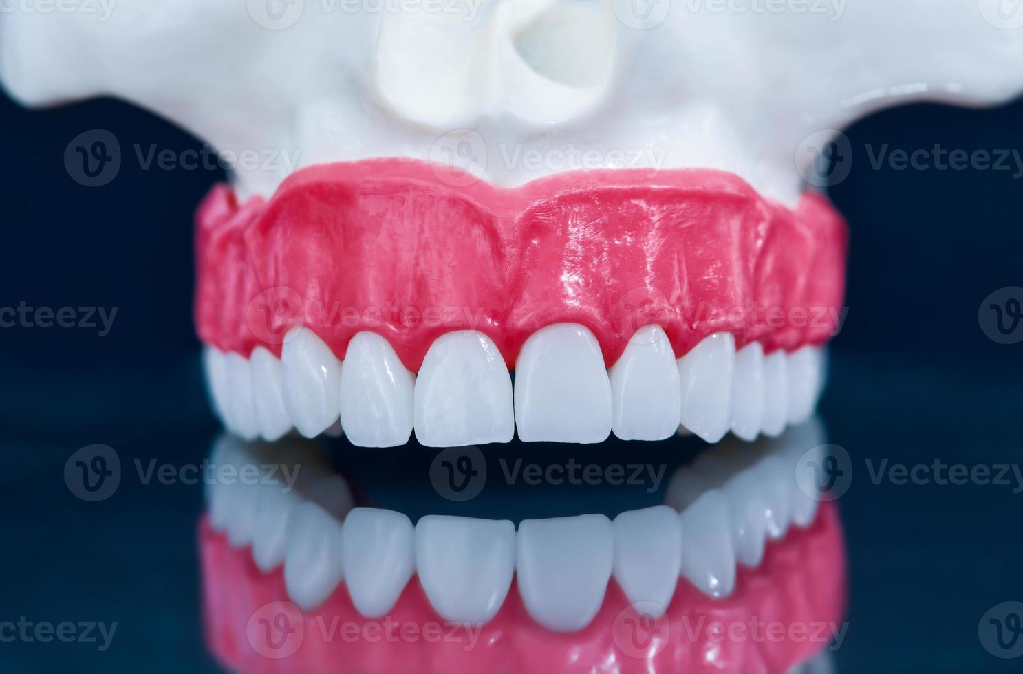 Upper human jaw model with a reflection on the glass photo