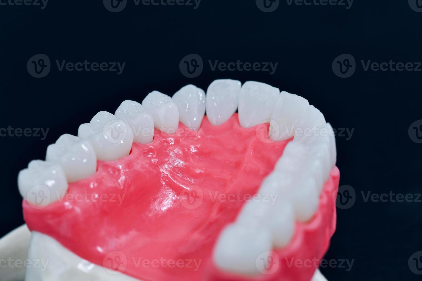 Upper human jaw with teeth and gums anatomy model photo