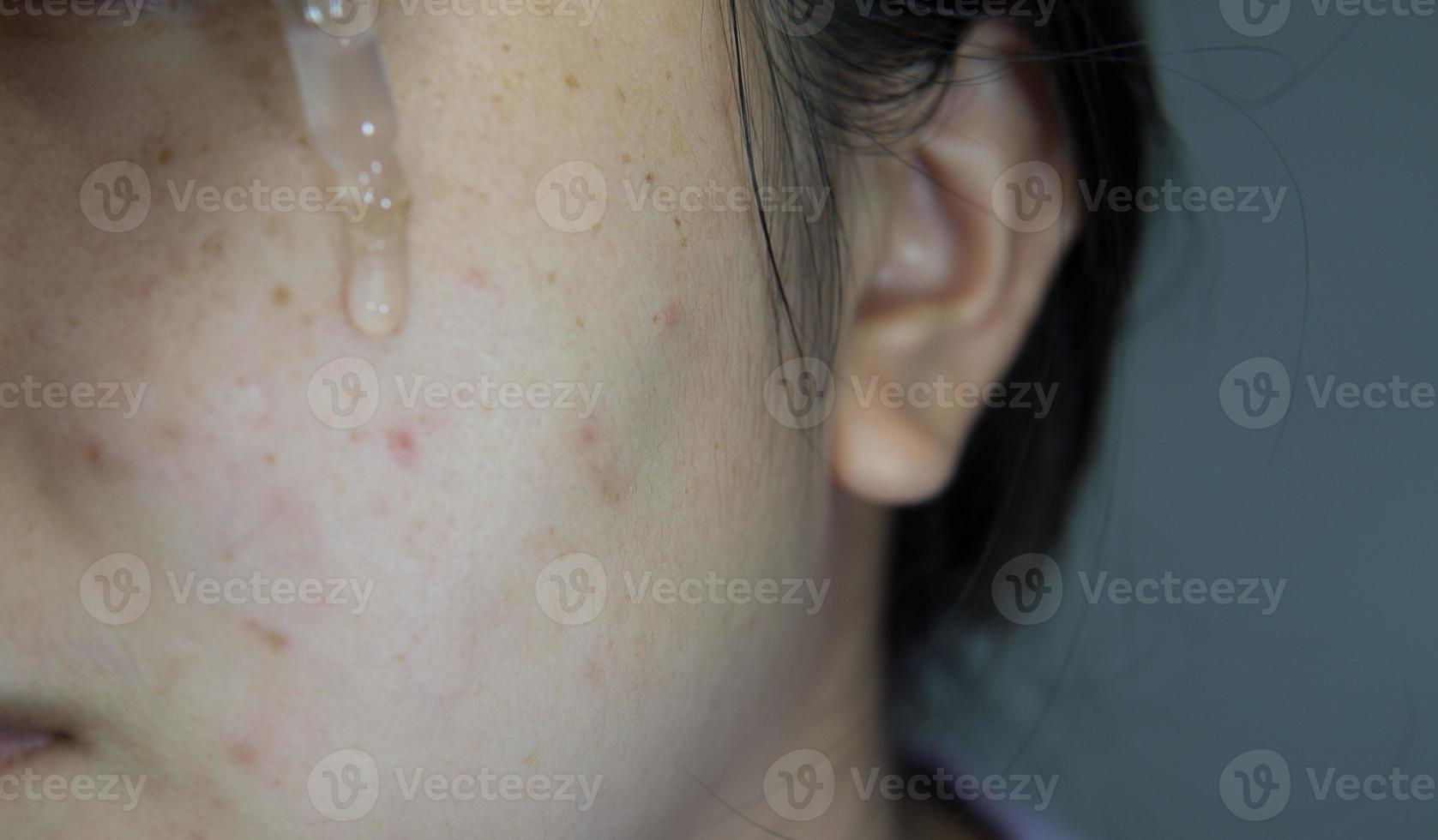 suero facial para mujeres foto