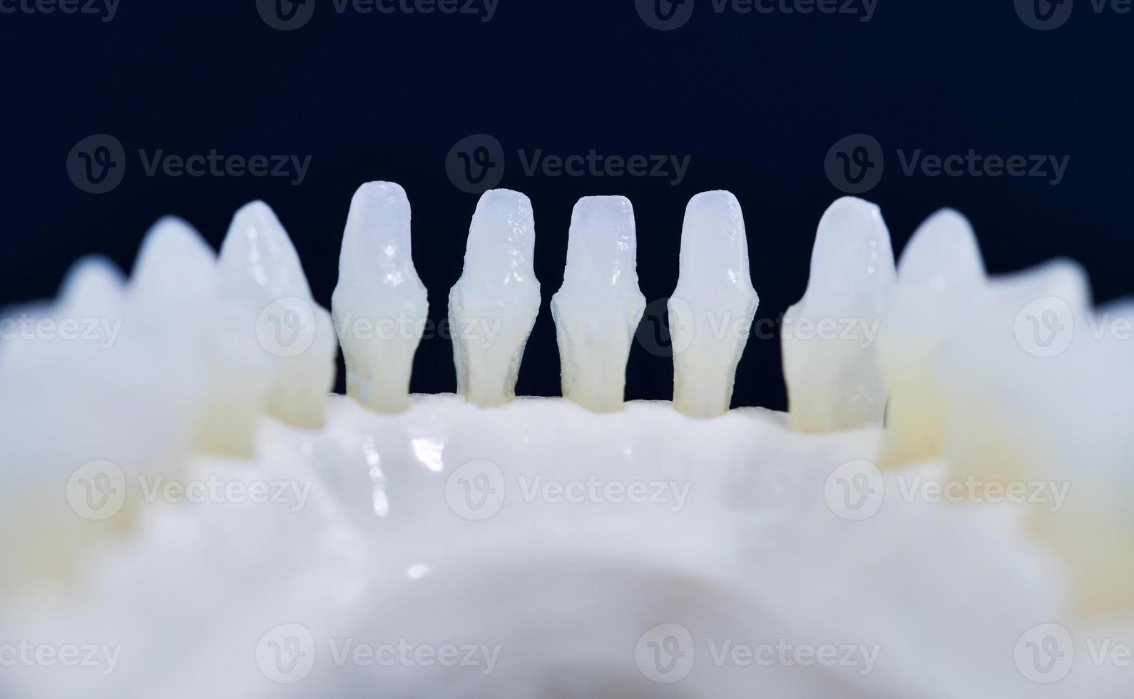 Lower human jaw with teeth anatomy model photo