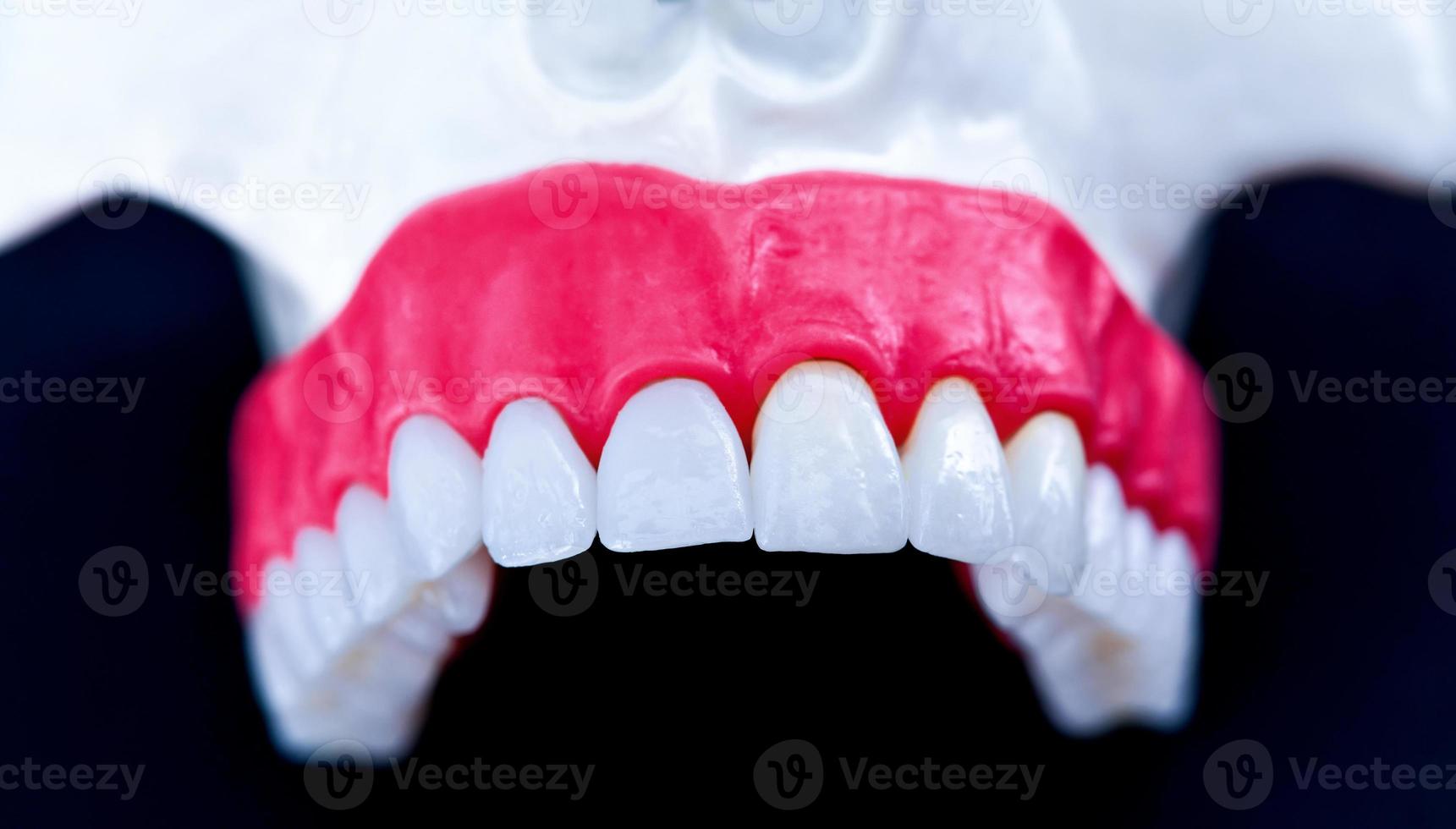 Upper human jaw with teeth and gums anatomy model photo