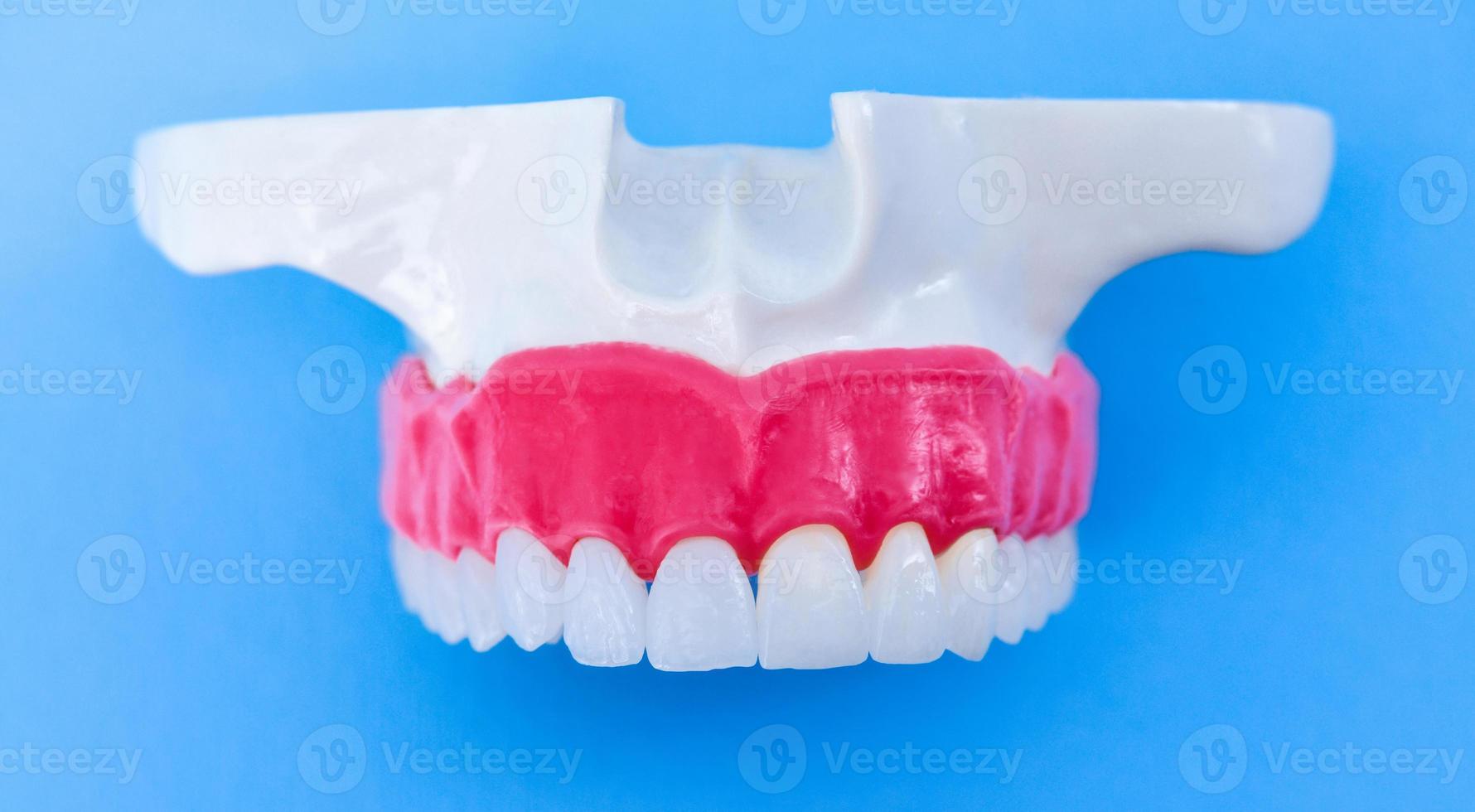 Upper human jaw with teeth and gums anatomy model photo