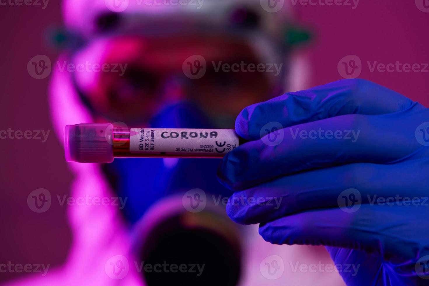 coronavirus, médico con tubo de ensayo de muestra de sangre del virus covid-19 positivo foto