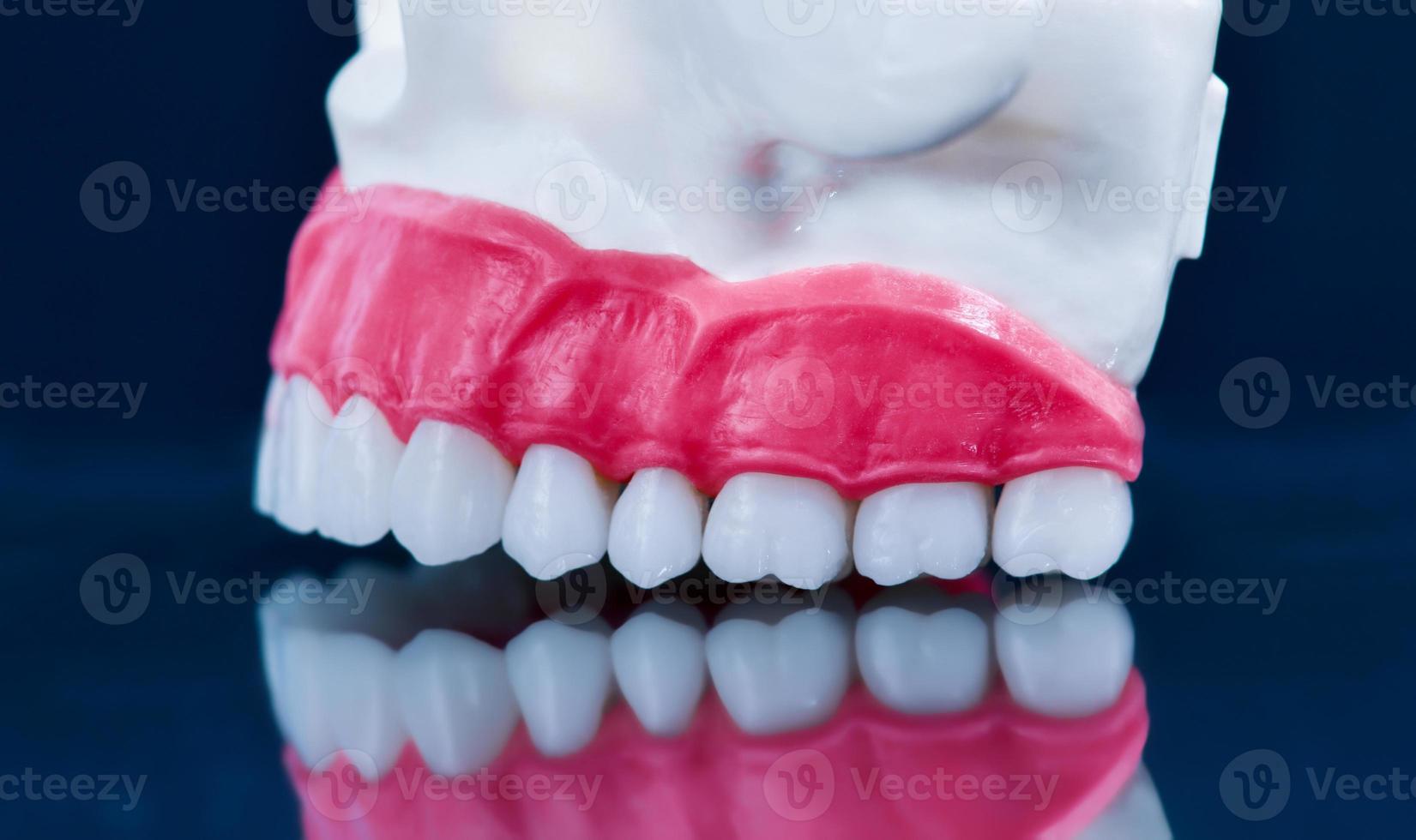 Upper human jaw model with a reflection on the glass photo