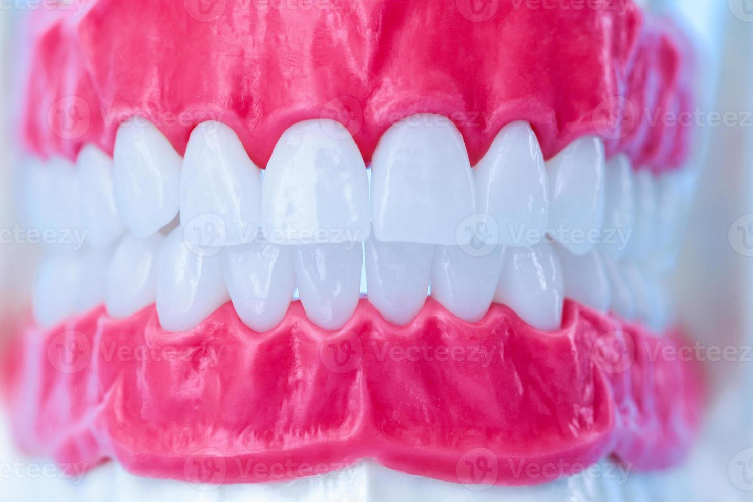 modelo de anatomía de mandíbula humana con dientes y encías foto