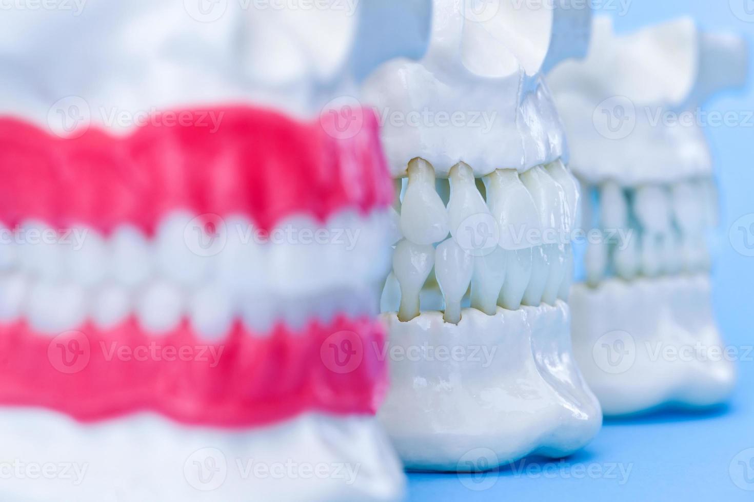Human jaws with teeth and gums anatomy models photo
