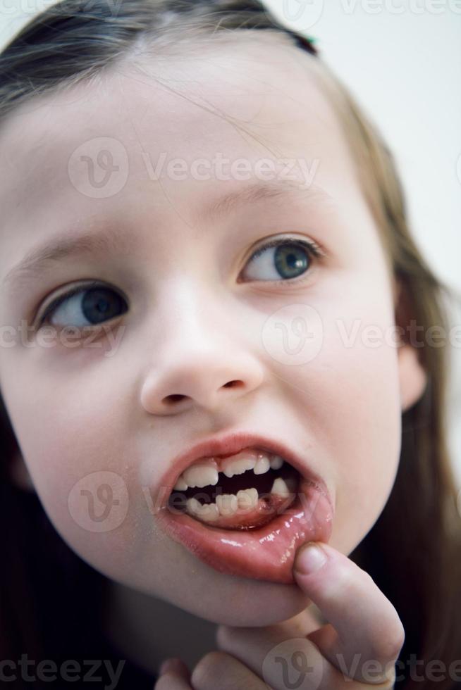 little girl without tooth smiling photo