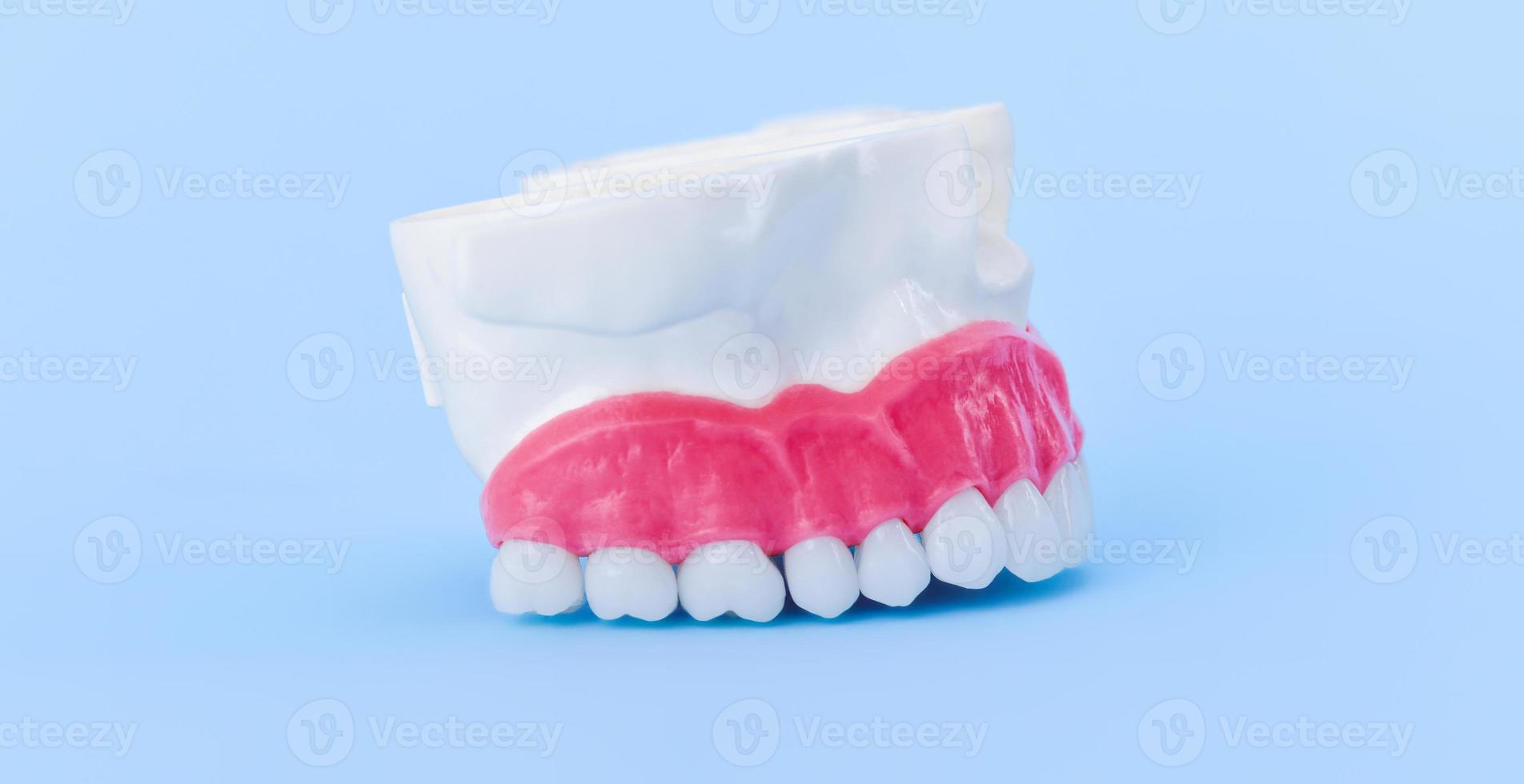 Upper human jaw with teeth and gums anatomy model photo
