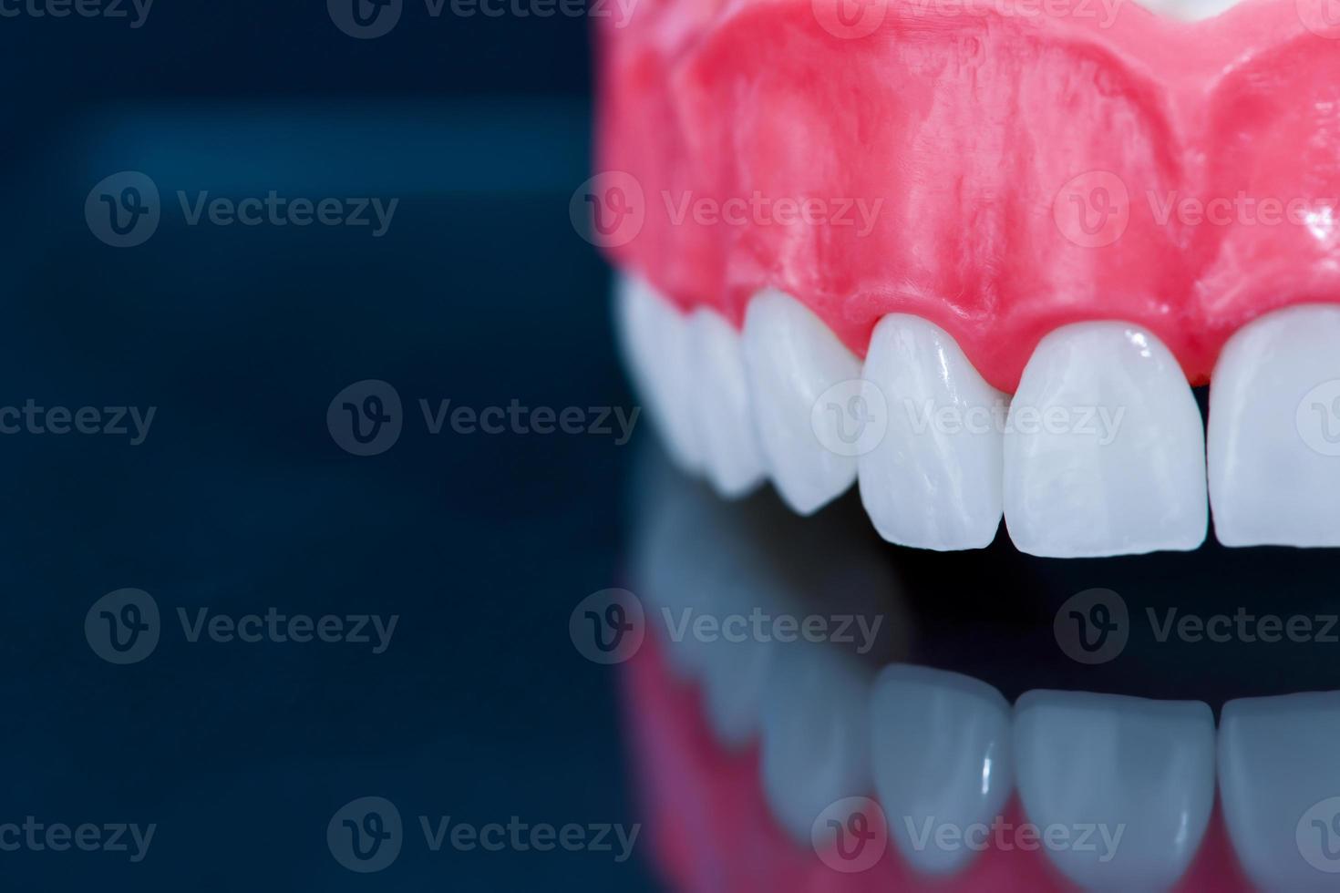 Upper human jaw model with a reflection on the glass photo