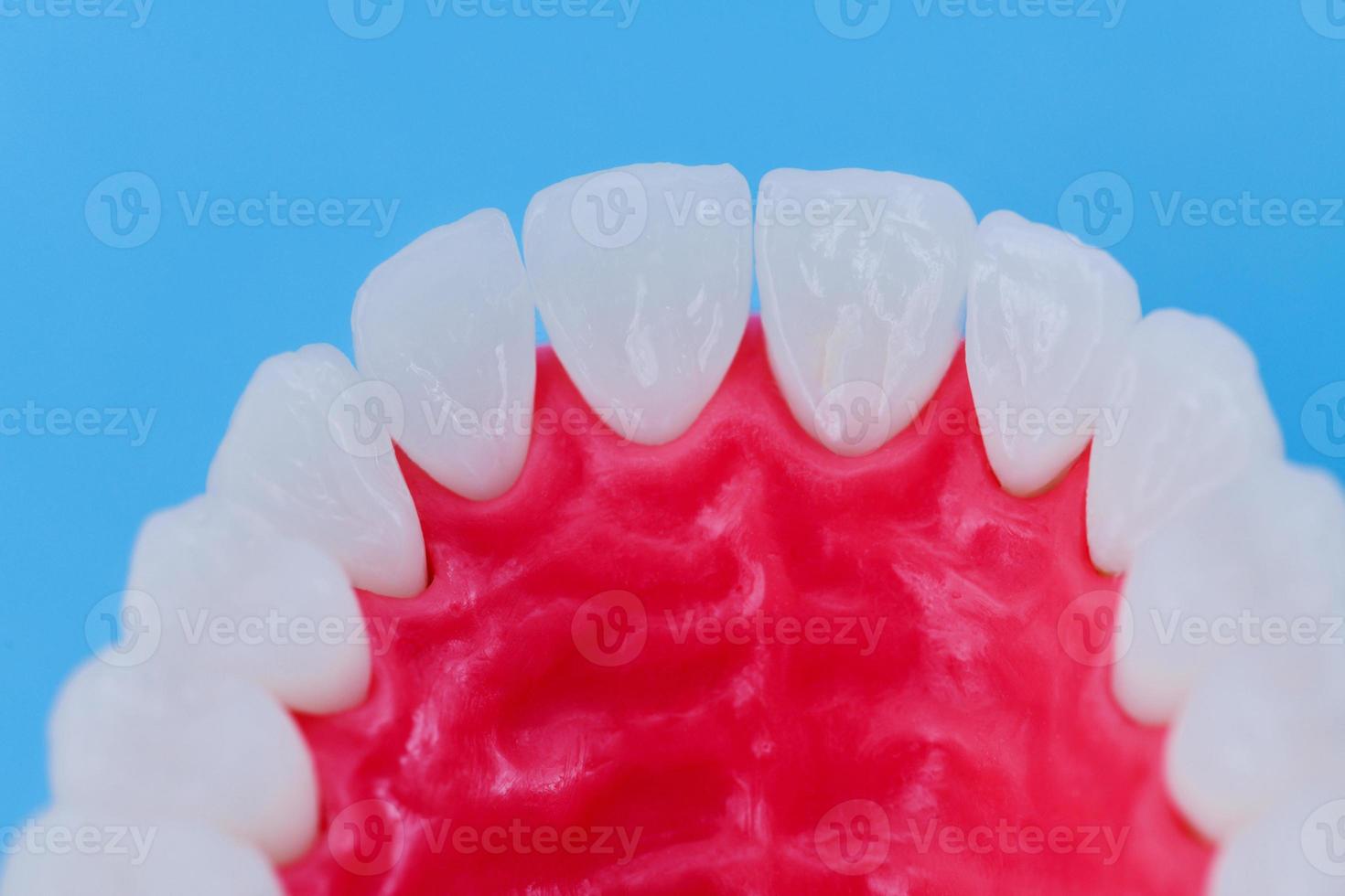 mandíbula superior humana con modelo de anatomía de dientes y encías foto