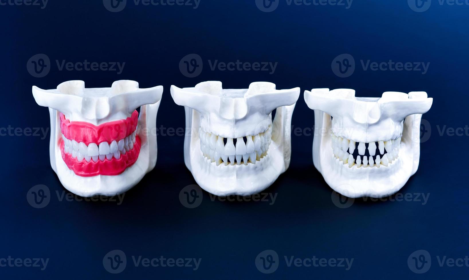Human jaws with teeth and gums anatomy models photo