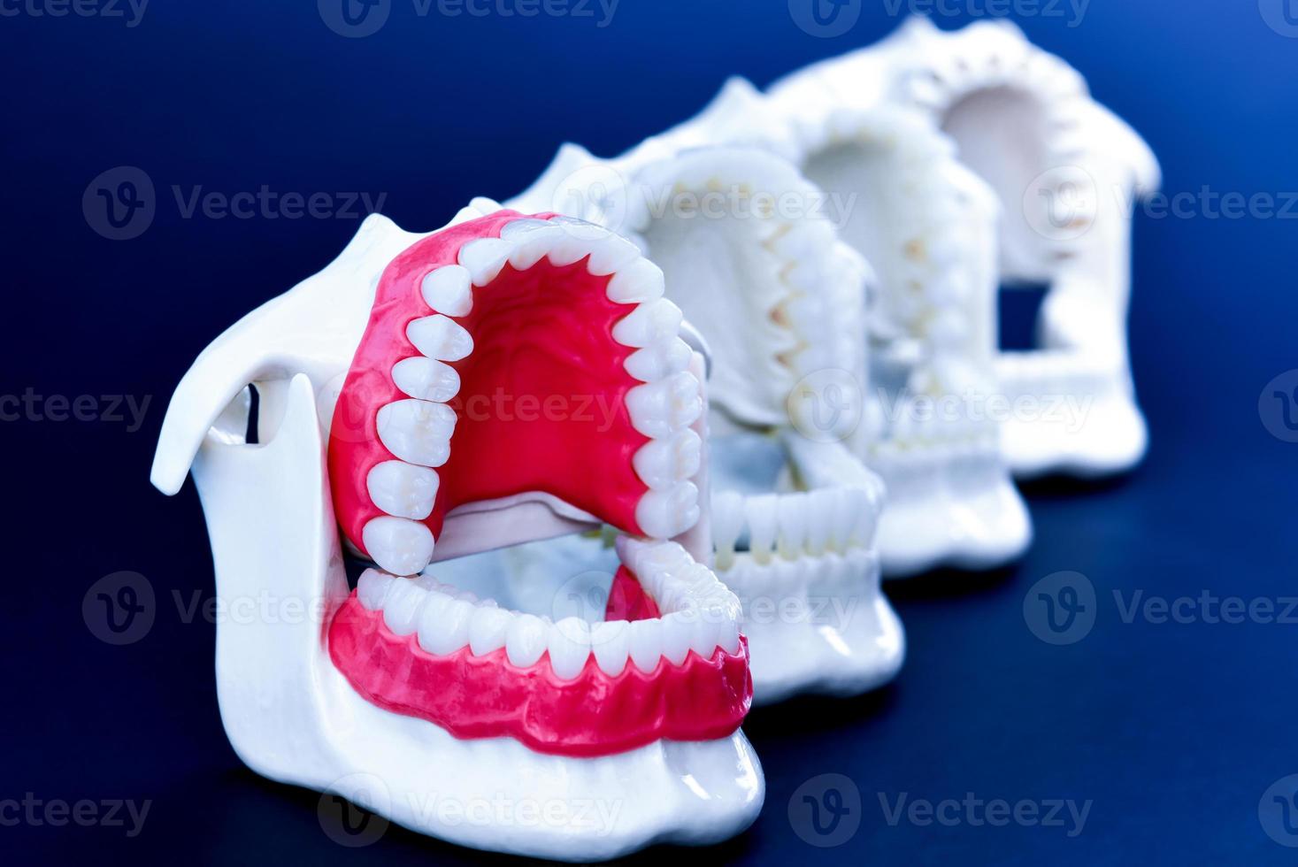 Dentist orthodontic teeth models photo