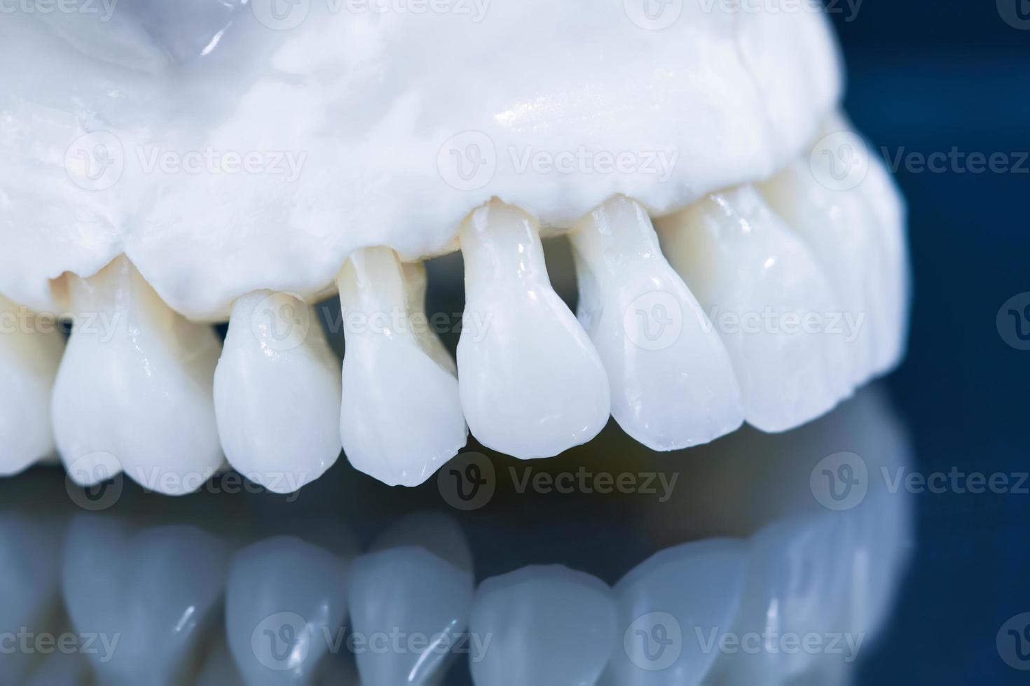 Upper human jaw model with a reflection on the glass photo