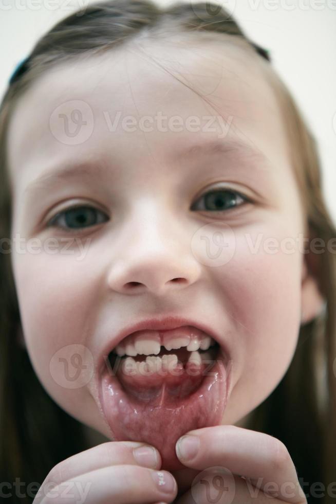 little girl without tooth smiling photo