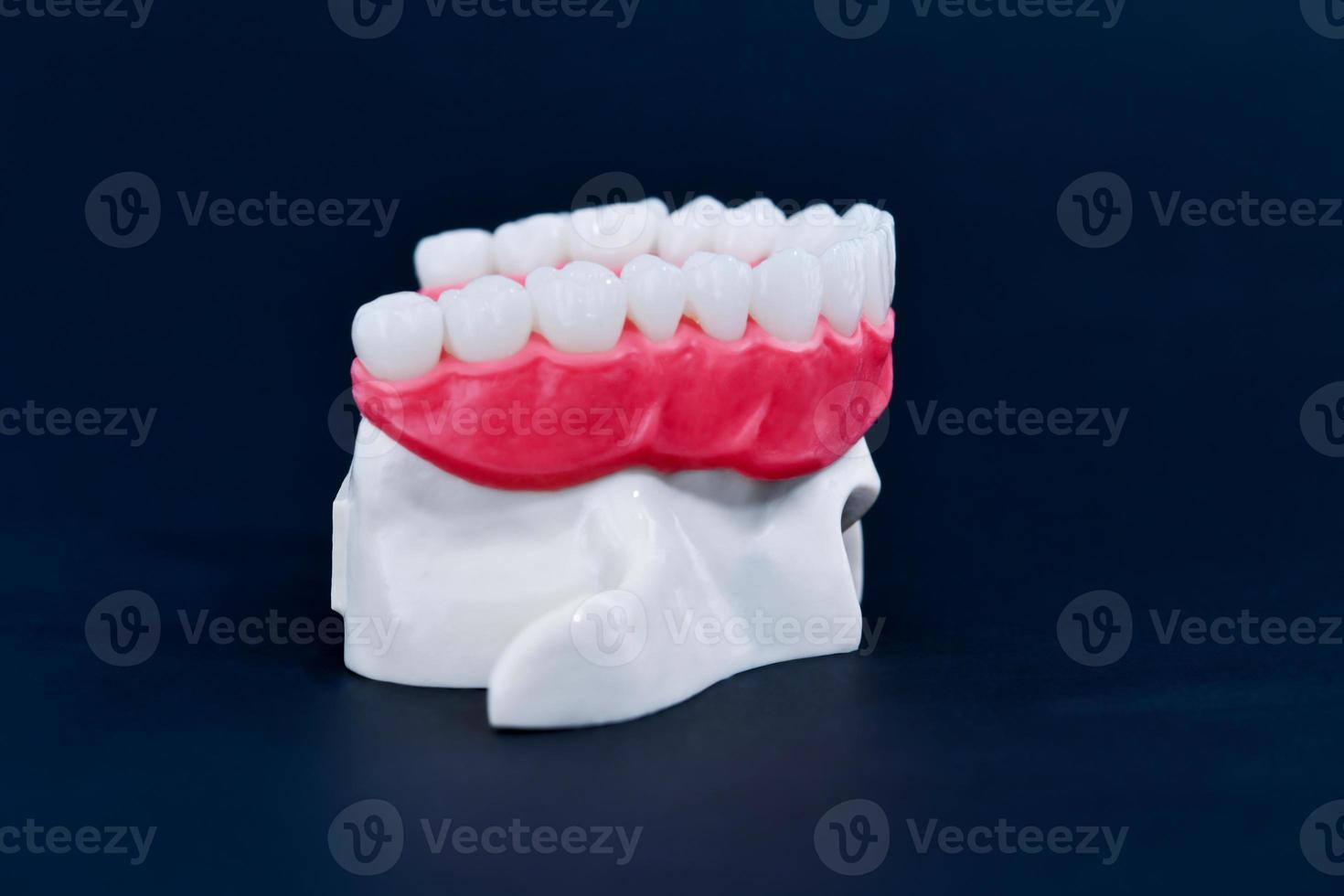 Upper human jaw with teeth and gums anatomy model photo