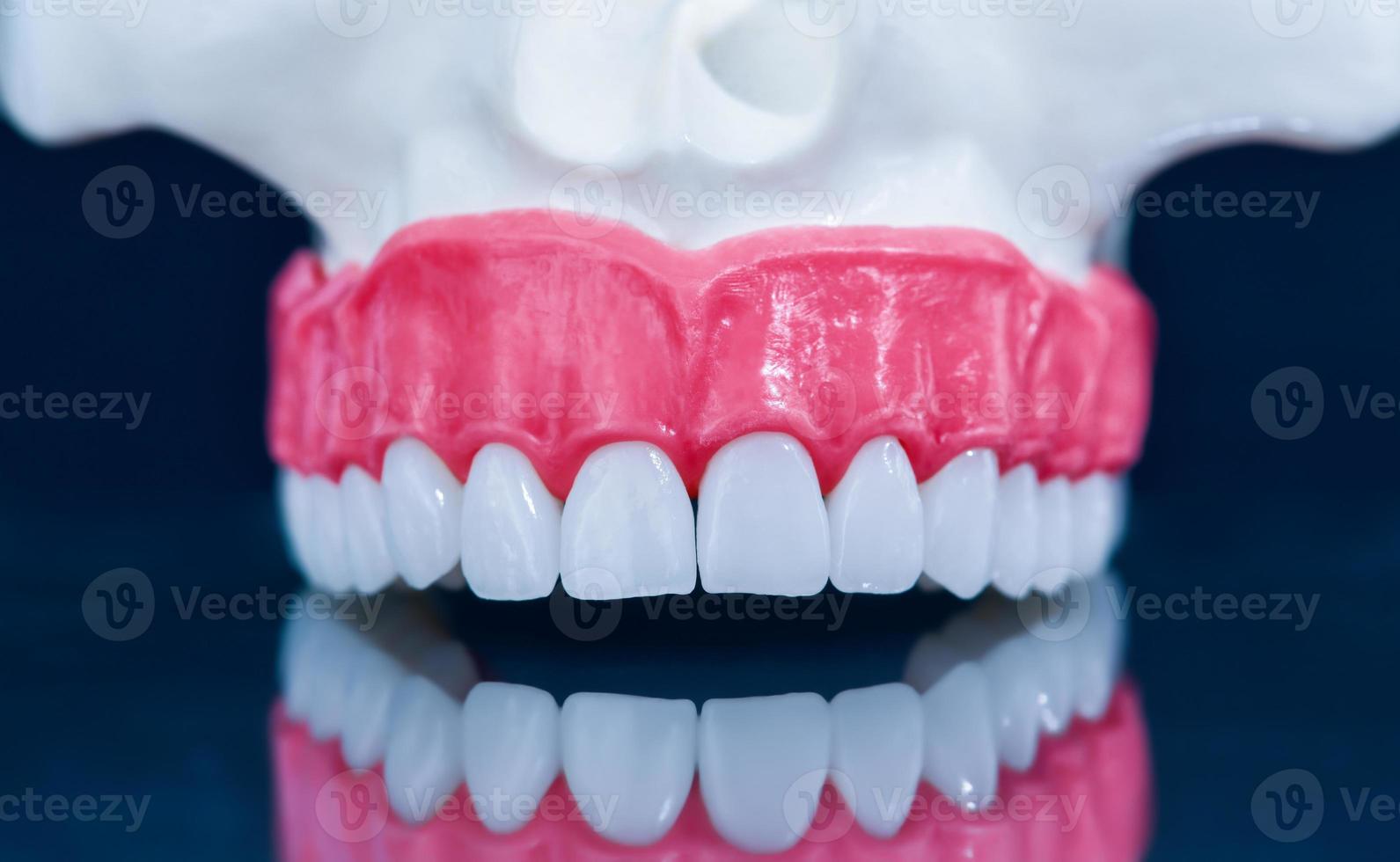Upper human jaw model with a reflection on the glass photo