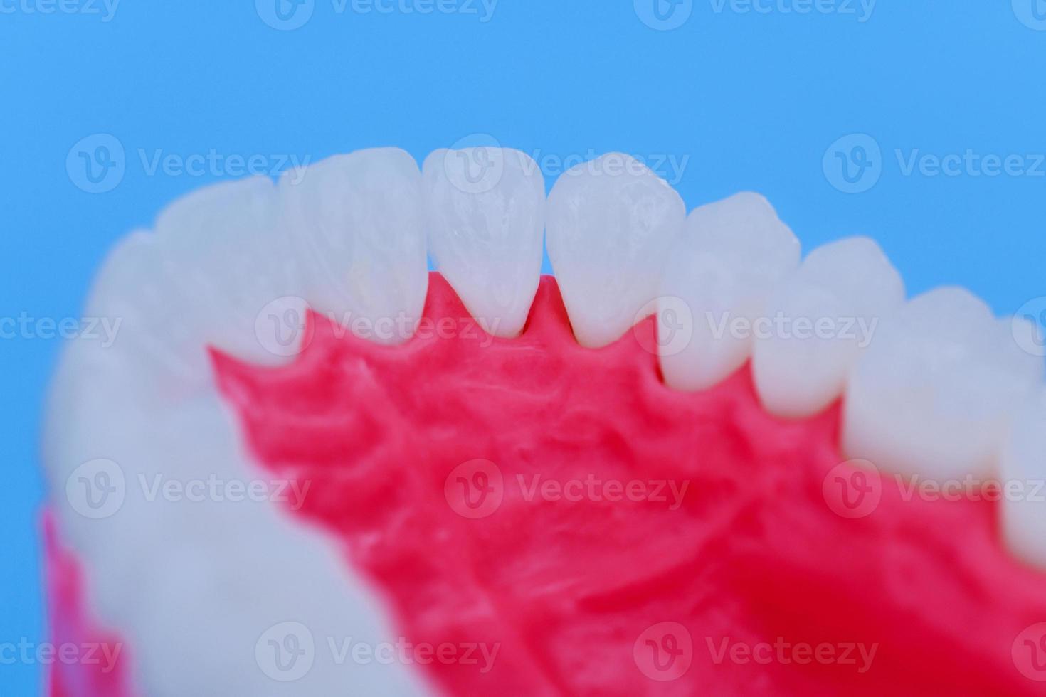 Upper human jaw with teeth and gums anatomy model photo