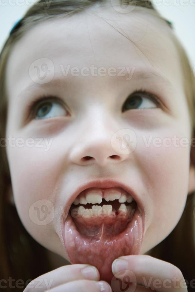 little girl without tooth smiling photo