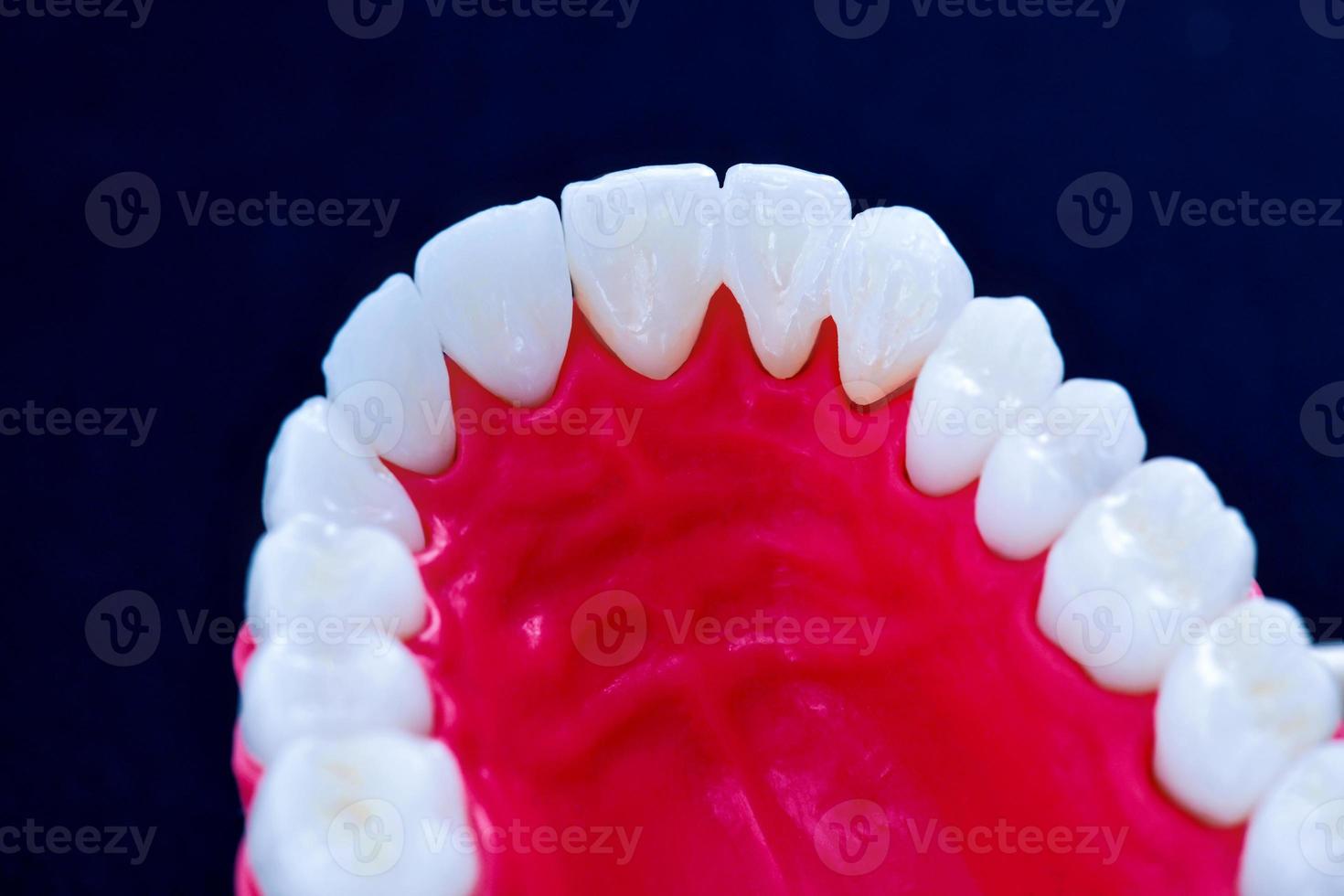 mandíbula superior humana con modelo de anatomía de dientes y encías foto