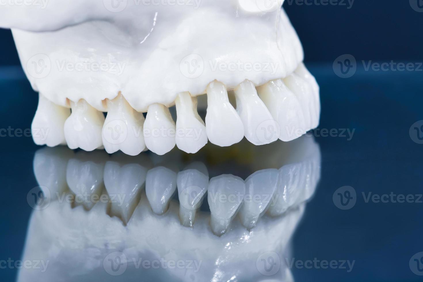 Upper human jaw model with a reflection on the glass photo