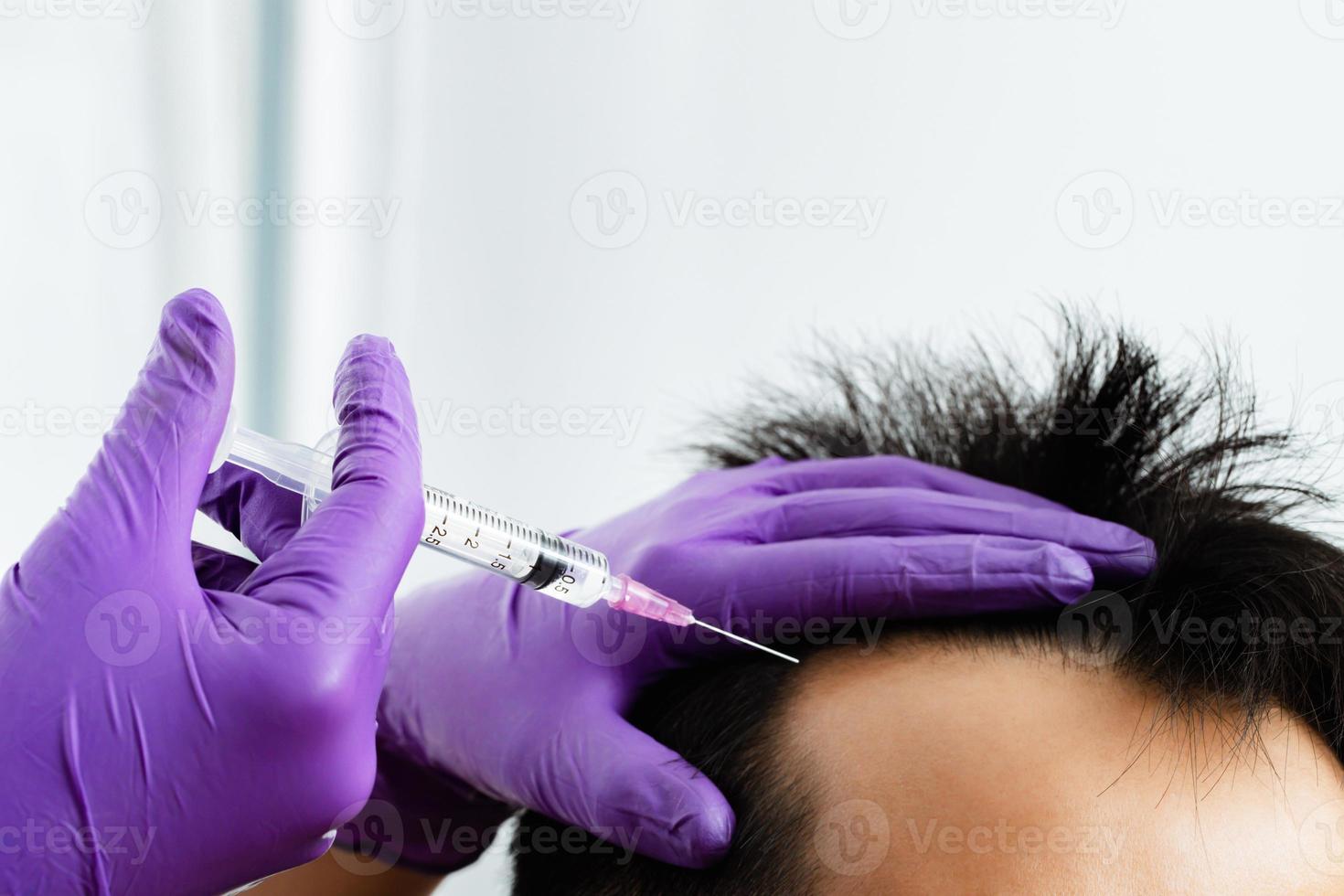 Permanent hair transplant by transplanting hair cells without surgery The wound heals quickly, leaving no scars. Suitable for people with hair loss and baldness problems. photo