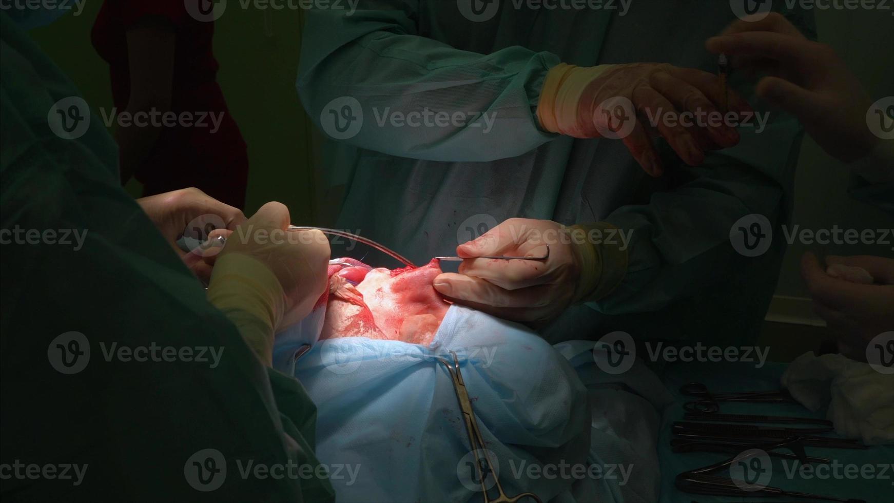 Surgeon and his assistant performing cosmetic surgery on nose photo