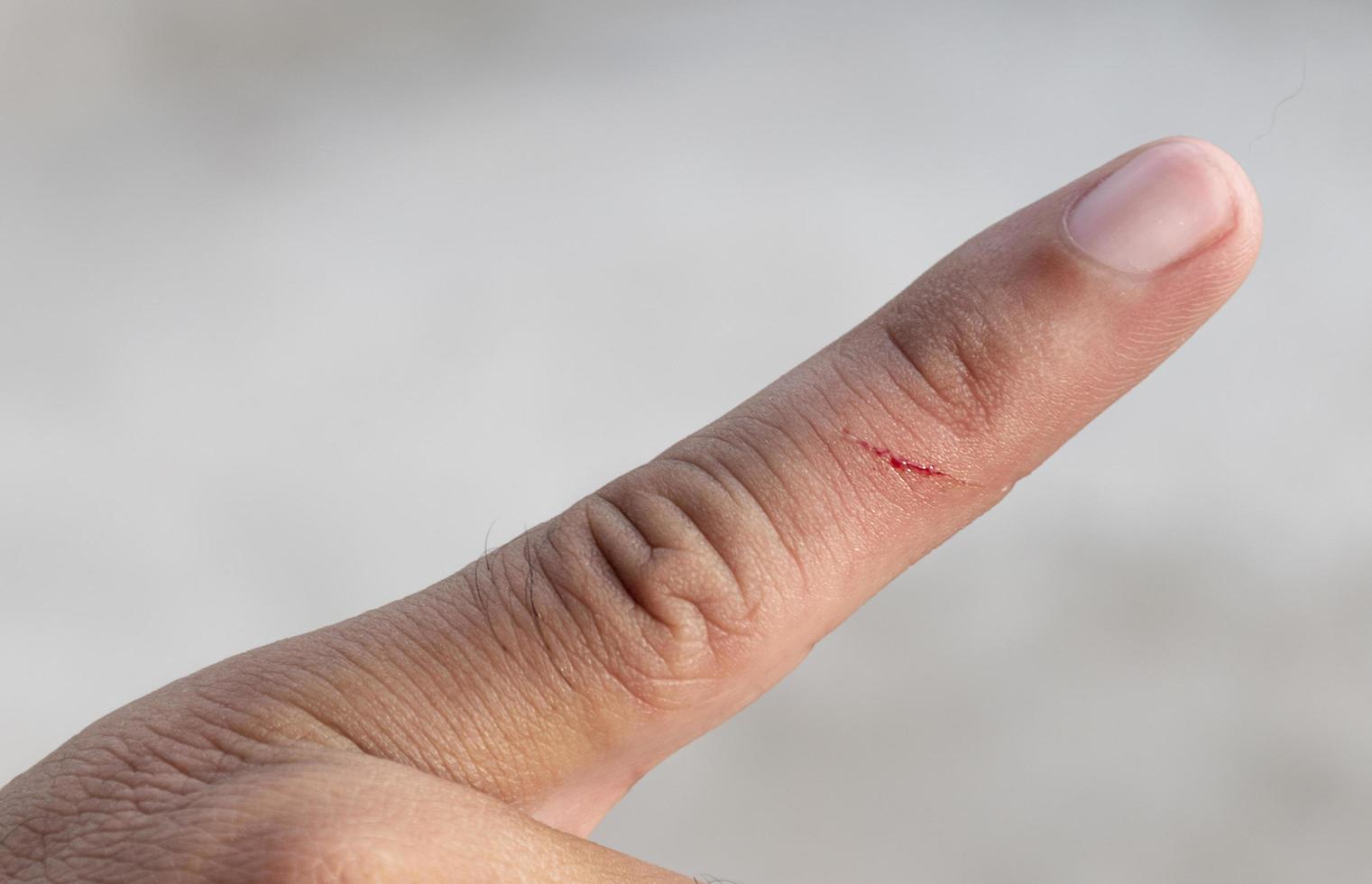 Wounded forefinger has blood stains photo