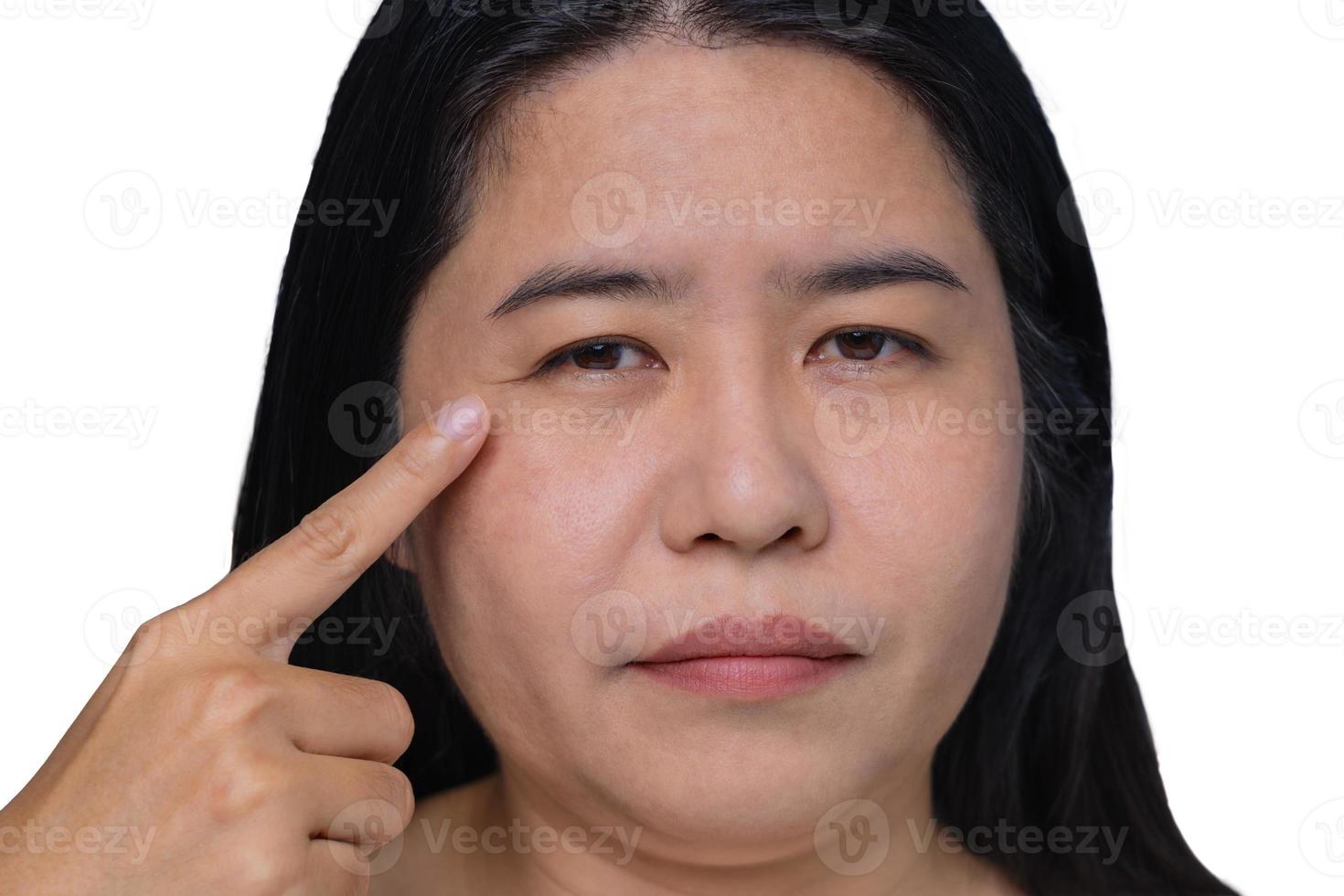 mujer asiática que muestra la flacidez de la piel adiposa flácida, manchas flácidas y oscuras en la cara, celulitis debajo de los ojos, líneas de la frente en la cara, problema arrugado y envejecido de mujer de mediana edad. foto