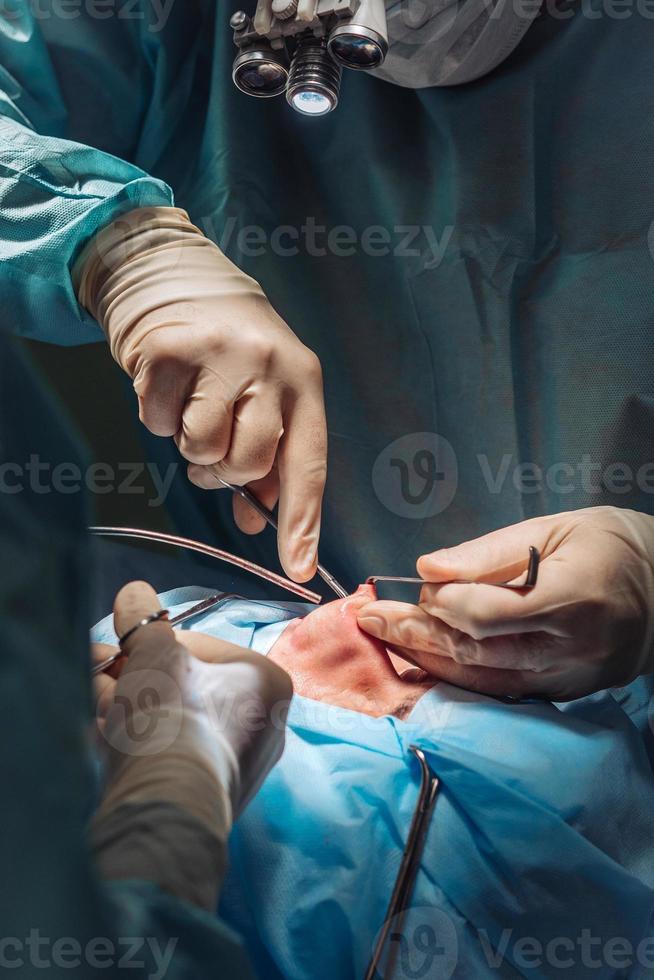 Cosmetic surgery on nose. The surgeon cuts the flesh photo