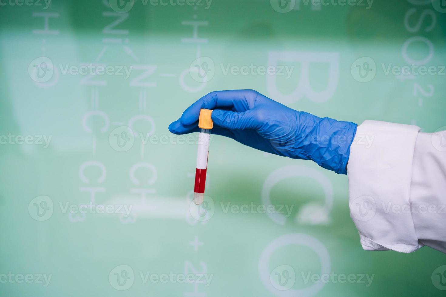 A rubber-gloved hand holds one test tube with the drug photo