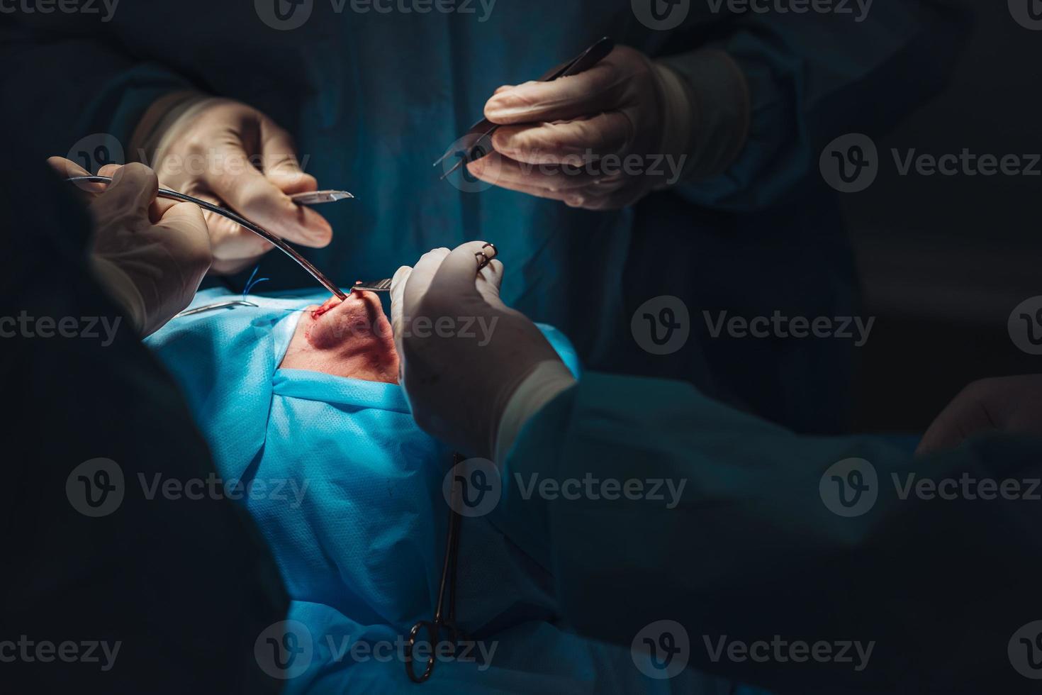 Surgeon and his assistant performing cosmetic surgery on nose photo