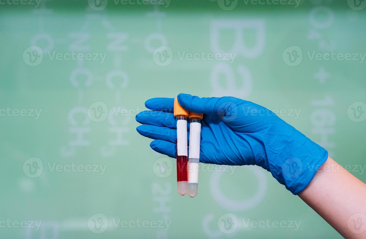 A rubber-gloved hand holds two test tube with the drug photo