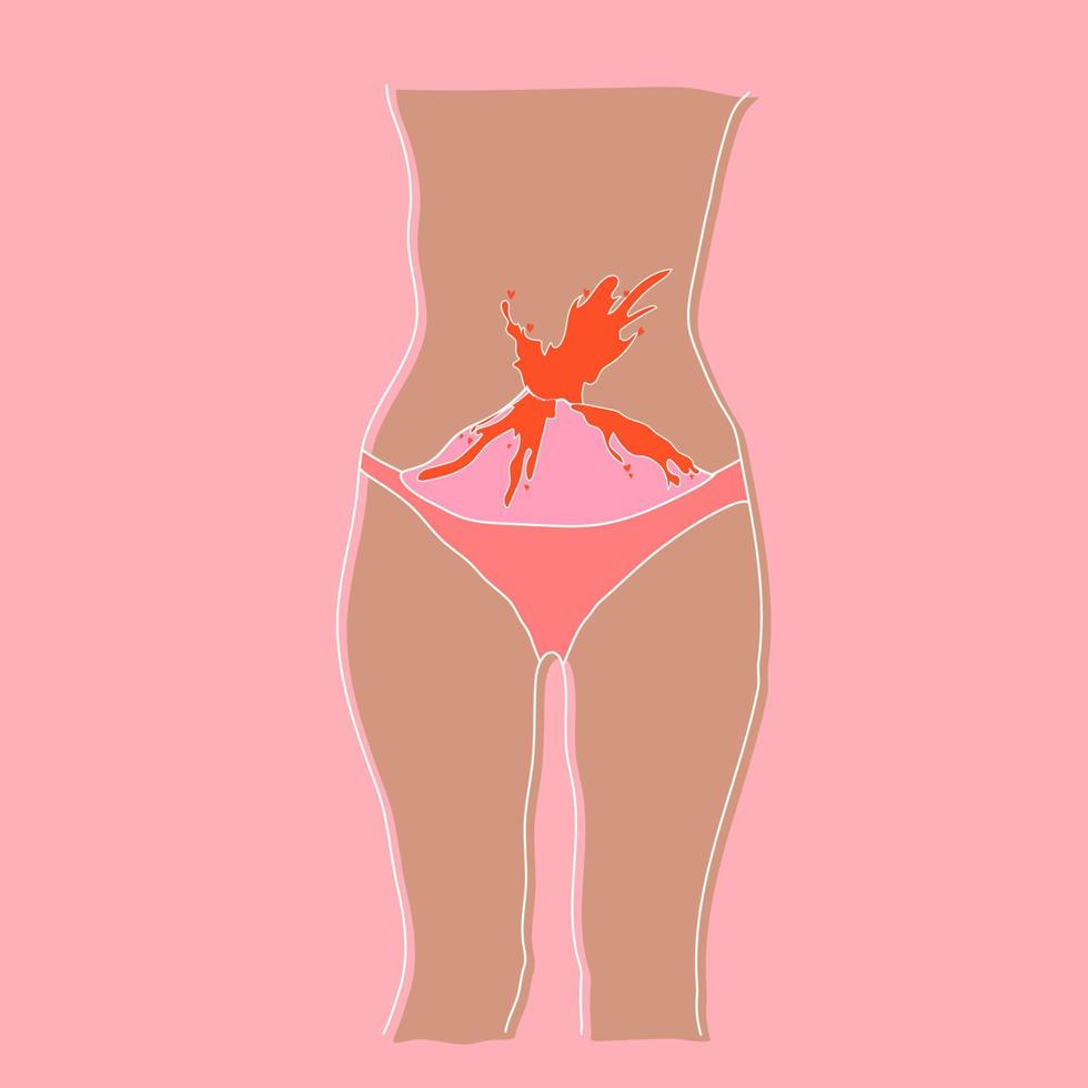 folleto sobre la menstruación. la menstruación causa malestar y posible dolor. es normal ser una mujer con cicatrices y crecimientos en el cuerpo. vector. vector