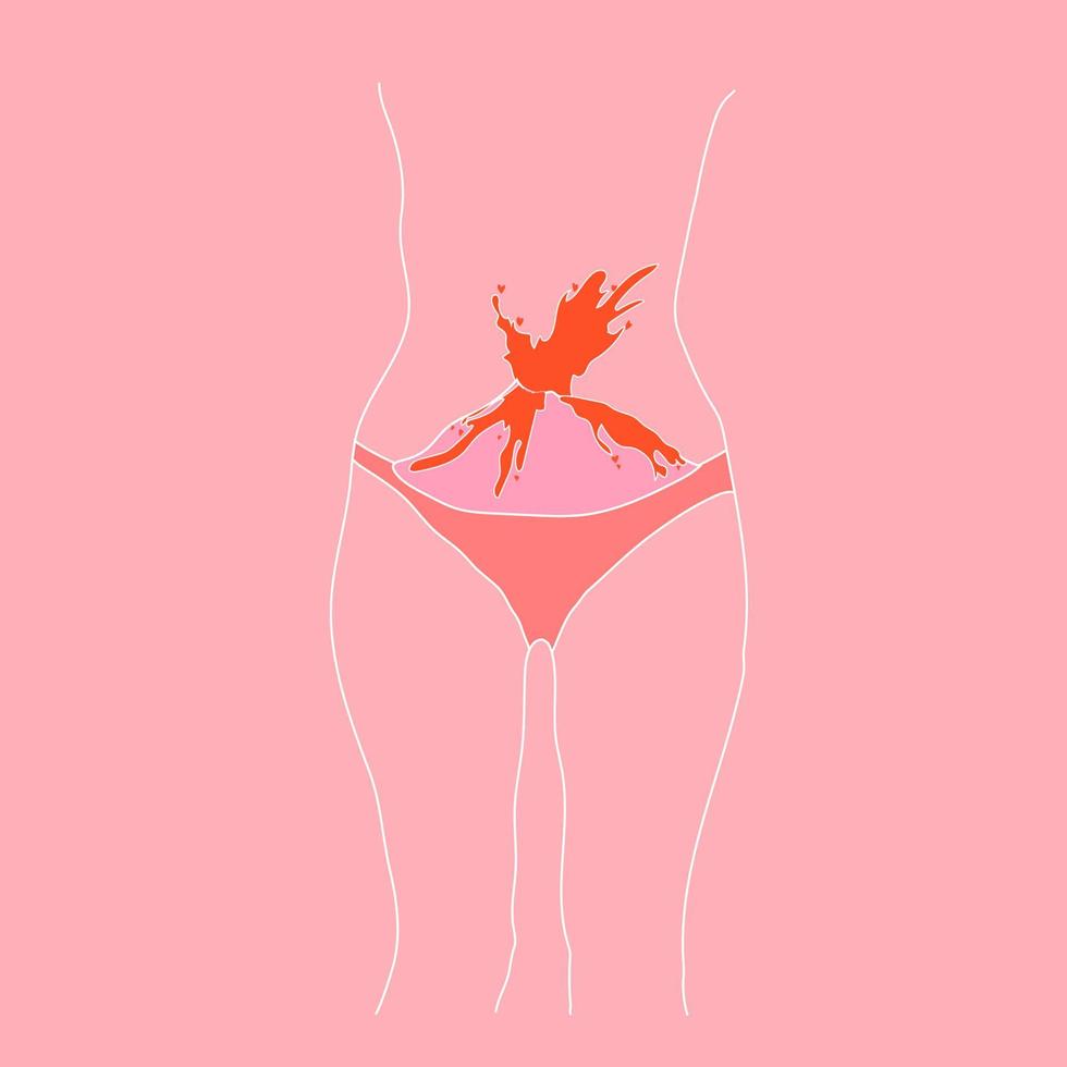 leaflet about menstruation. Menstruation causes discomfort and possible pain. It is normal to be a woman with scars and growths on the body. Vector. vector