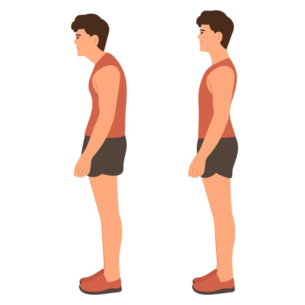 Correct and incorrect standing posture.Cervical spinal curvature. Hump. Healthy back.Vector illustration on white background. vector