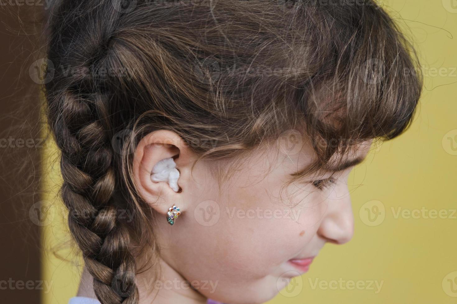 Girl with a warming therapeutic cotton swab in the ear with a sad and tearful face is holding her ear. Ear pain, otitis media, swelling of cheek, gums, toothache, children's surgery, otolaryngology photo