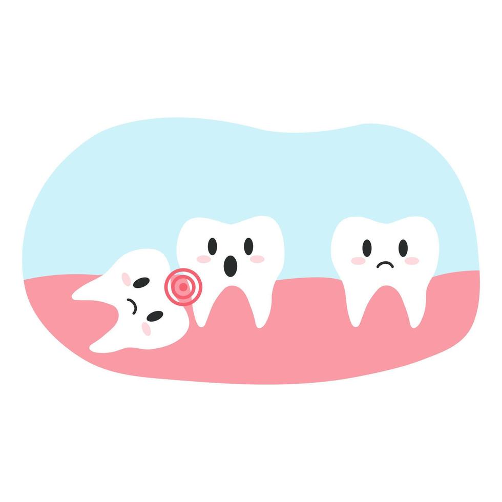 Impacted wisdom tooth in cartoon flat style. Vector illustration of disgruntled teeth characters, dental health concept, oral hygiene